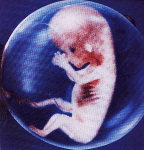 FETUS.gif