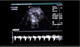 Sonogram_lawsuit_news_story.png